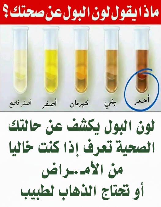 لون البول يدل على حالتك الصحيه